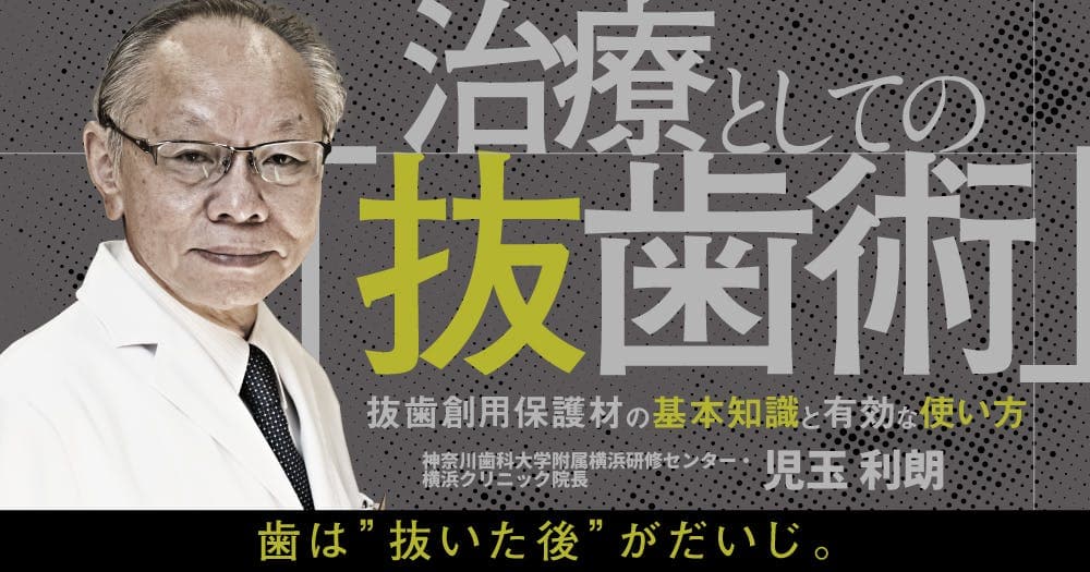 治療としての「抜歯術」