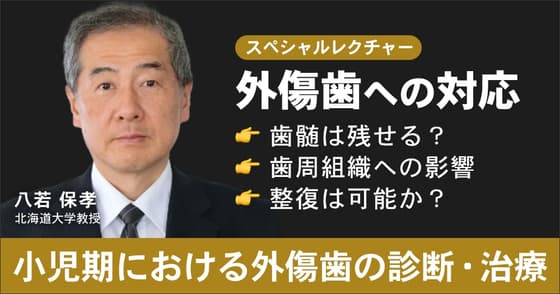「外傷歯」の診断とステージごとの対応
