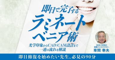 即日で完了するラミネートベニア術