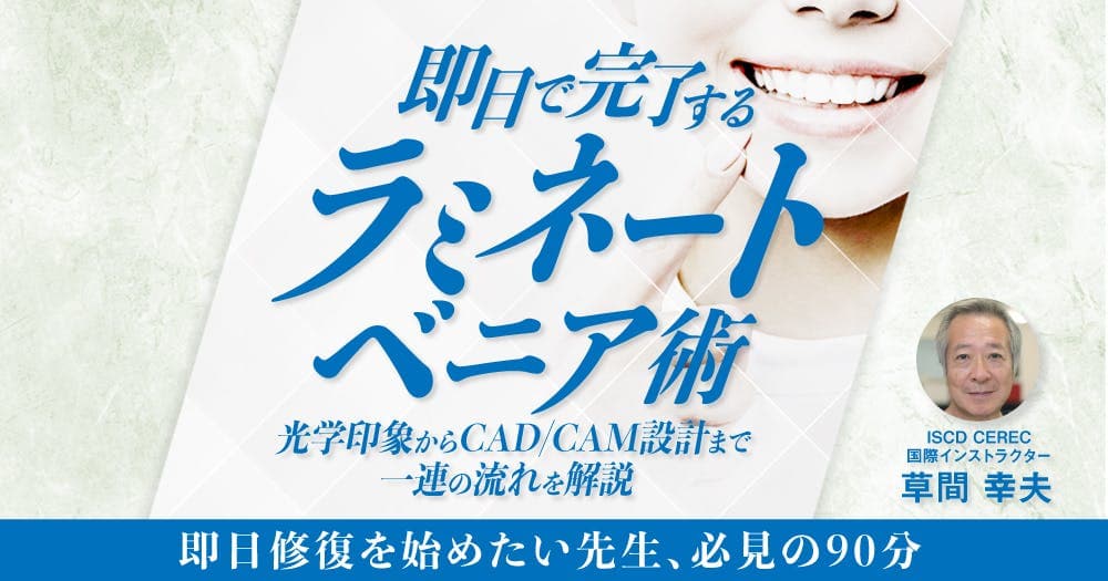 即日で完了するラミネートベニア術