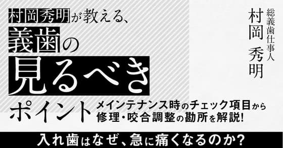 村岡 秀明が教える、義歯の「見るべき」ポイント