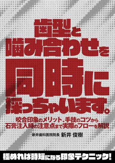ランキング8位の歯型と噛み合わせを同時に採っちゃいます。