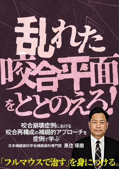 ランキング4位の乱れた咬合平面をととのえろ！