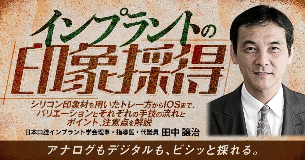 インプラントの印象採得 - シリコン印象材を用いたトレー方からIOSまで、バリエーションとそれぞれの手技の流れとポイント、注意点を解説