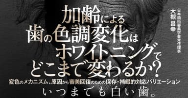 加齢による歯の色調変化はホワイトニングでどこまで変わるか？