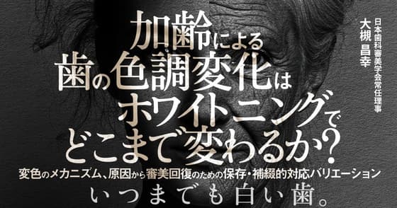 加齢による歯の色調変化はホワイトニングでどこまで変わるか？