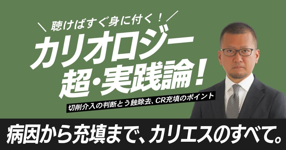 聴けばすぐ身に付く「カリオロジー」超・実践論！ - 切削介入の判断とう蝕除去、CR充填のポイント