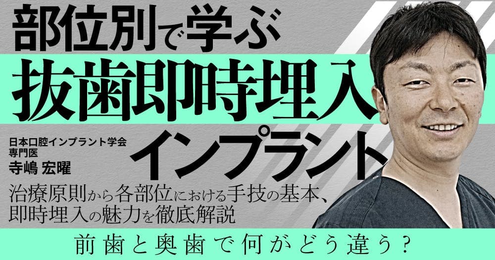 部位別で学ぶ「抜歯即時埋入」インプラント - 治療原則から各部位における手技の基本、即時埋入の魅力を徹底解説