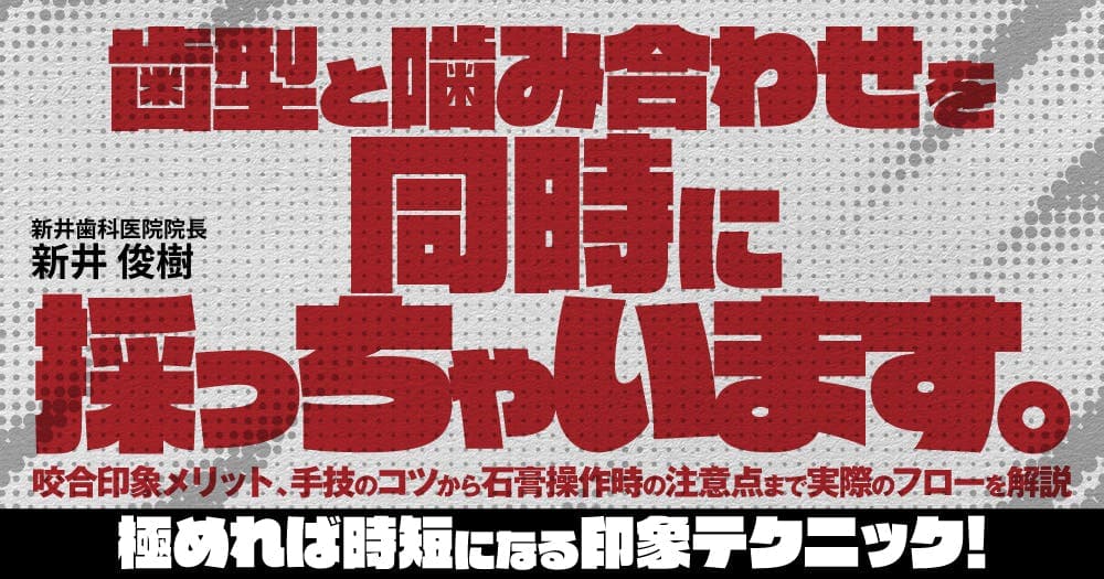 歯型と噛み合わせを同時に採っちゃいます。 - 咬合印象メリット、手技のコツから石膏操作時の注意点まで実際のフローを解説