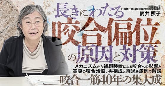 長きにわたる「咬合偏位」の原因と対策
