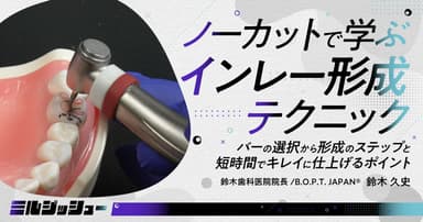 ノーカットで学ぶ「インレー形成」テクニック