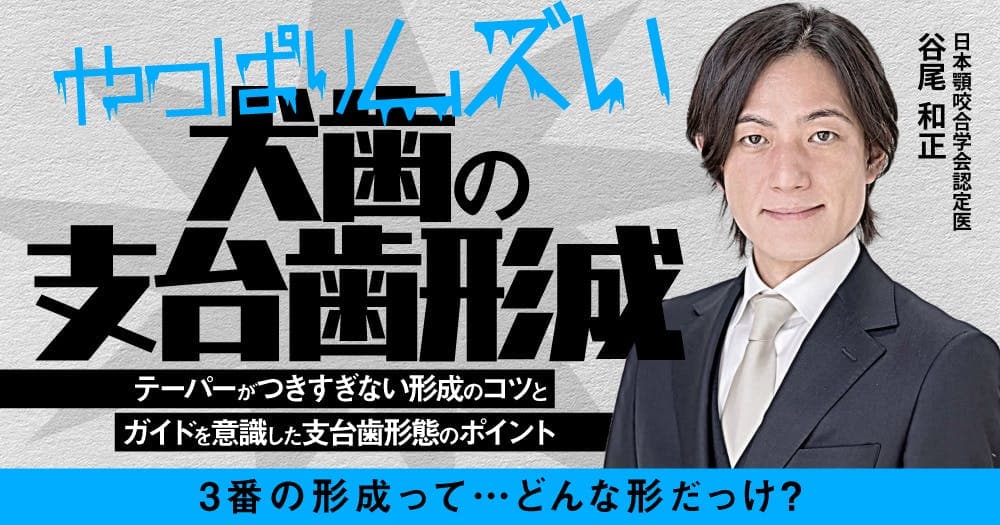 やっぱりムズい「犬歯の支台歯形成」 - テーパーがつきすぎない形成のコツとガイドを意識した支台歯形態のポイント
