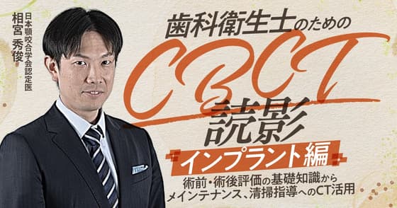 歯科衛生士のためのCBCT読影「インプラント」編