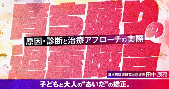 育ち盛りの「過蓋咬合」