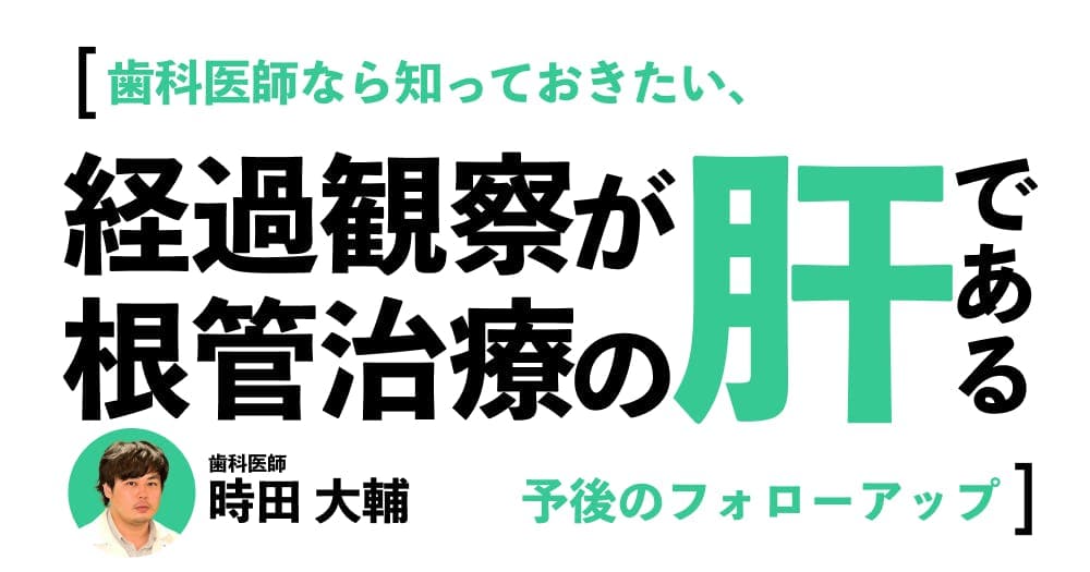 「経過観察」が根管治療の肝である