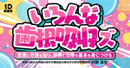 いろんな歯根吸収ズ