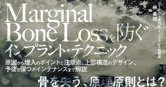 Marginal Bone Lossを防ぐインプラント・テクニック