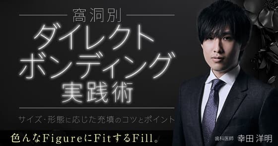 【窩洞別】ダイレクトボンディング実践術