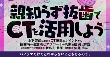 親知らず抜歯でCTを活用しよう