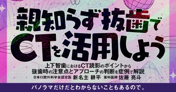 親知らず抜歯でCTを活用しよう