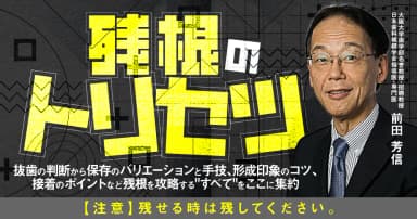 残根のトリセツ