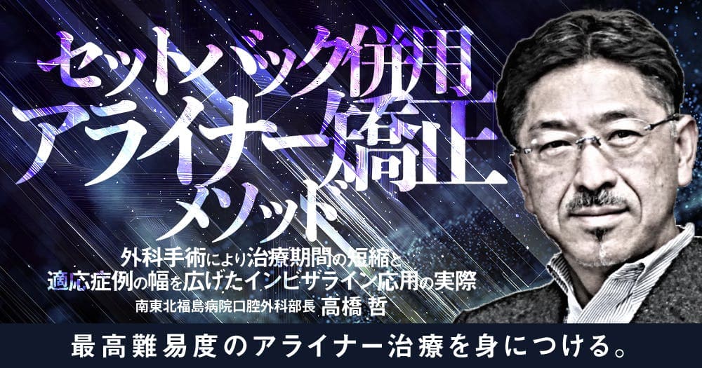 セットバック併用アライナー矯正メソッド - 外科手術により治療期間の短縮と適応症例の幅を広げたインビザライン応用の実際