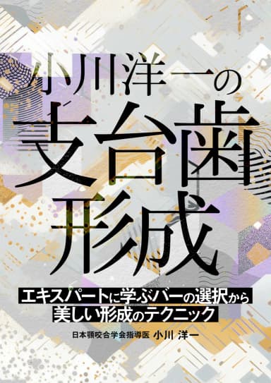 ランキング10位の小川洋一の支台歯形成