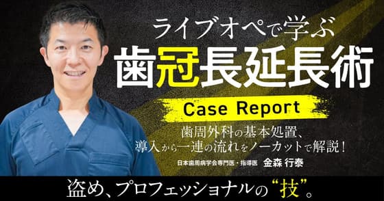 ライブオペで学ぶ「歯冠長延長術」＜Case Report＞