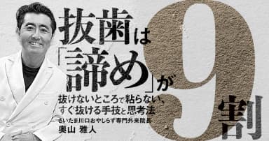 抜歯は「諦め」が9割