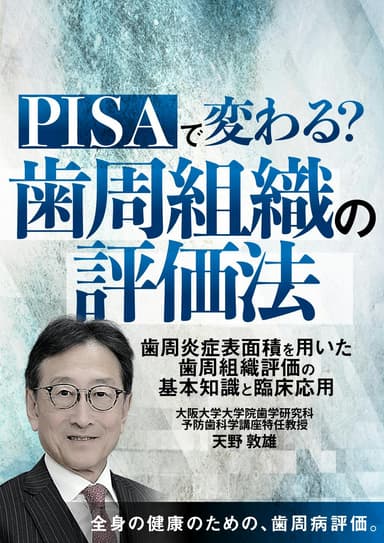 ランキング10位の「PISA」で変わる？歯周組織の評価法