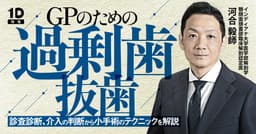 GPのための過剰歯抜歯