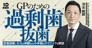 GPのための過剰歯抜歯
