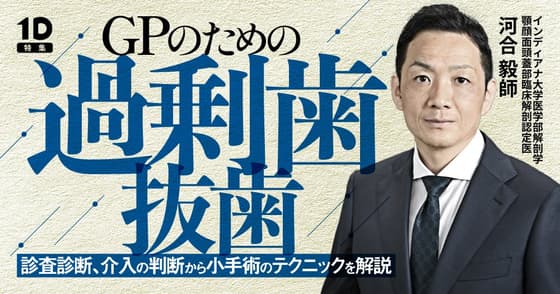 GPのための過剰歯抜歯