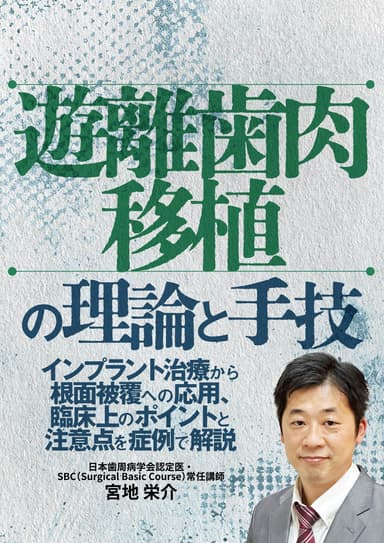 ランキング14位の遊離歯肉移植の理論と手技