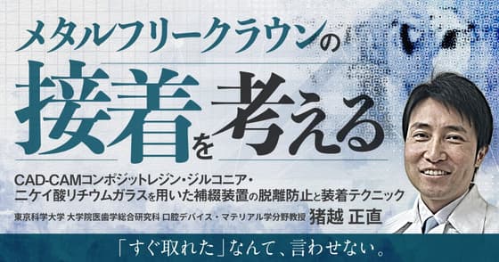 メタルフリークラウンの接着を考える