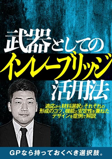 ランキング5位の武器としての「インレーブリッジ」活用法