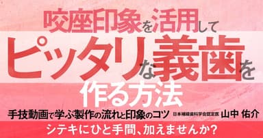  咬座印象を活用してピッタリな義歯を作る方法