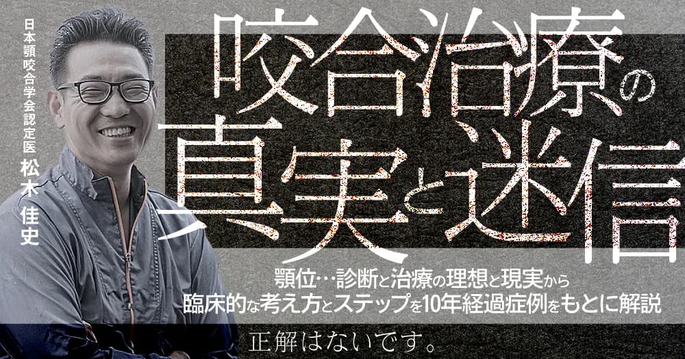 咬合治療の真実と迷信