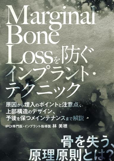 ランキング12位のMarginal Bone Lossを防ぐインプラント・テクニック