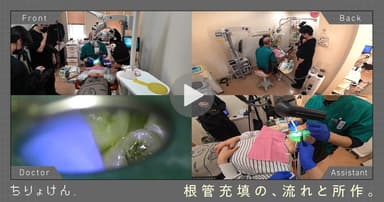 【治療見学】根管充填（上顎右側第二小臼歯）