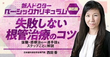 【第6回】失敗しない根管治療のコツ