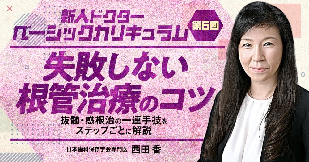 失敗しない根管治療のコツ