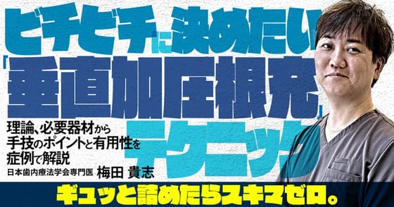 ビチビチに決めたい「垂直加圧根充」テクニック