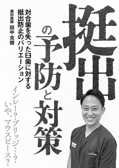 ランキング17位の「挺出」の予防と対策
