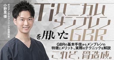 Tiハニカムメンブレンを用いたGBR