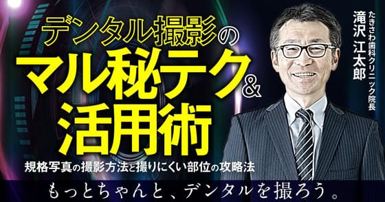 デンタル撮影のマル秘テク＆活用術