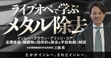 ライブオペで学ぶ「メタル除去」