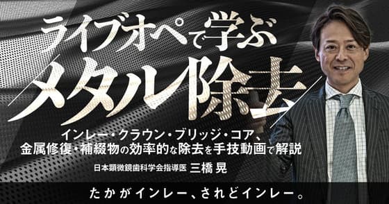 ライブオペで学ぶ「メタル除去」
