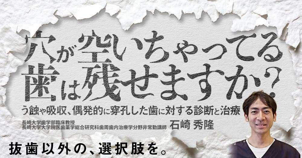穴が空いちゃってる歯は残せますか？