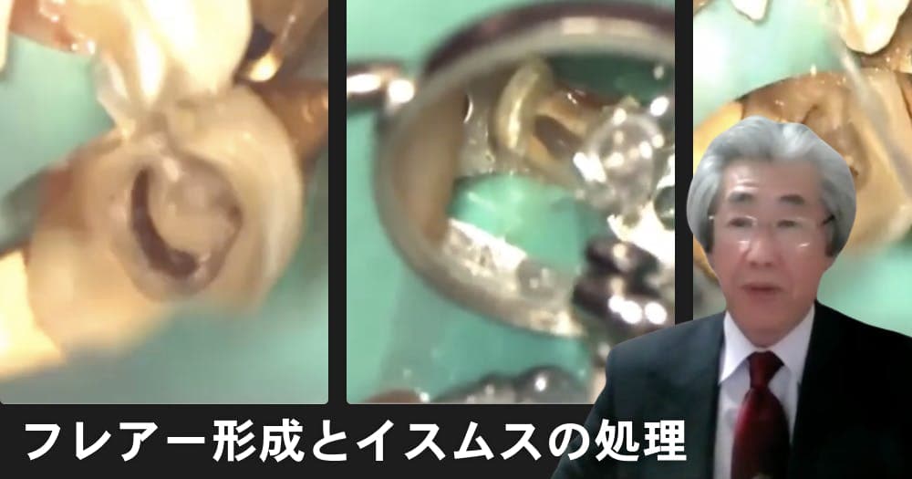 【切り抜き】フレアー形成とイスムスの処理 - 道具がなくても腕で乗り切るテクニック